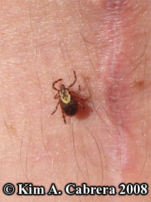 Tick on my
                      skin. Photo copyright by Kim A. Cabrera 2008.